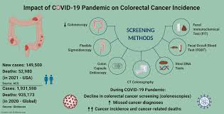 Image result for Colon Cancer Screening with Colonoscopy