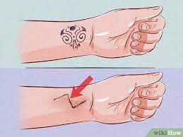How to get rid of a stick and poke with salt. 3 Ways To Remove A Tattoo Wikihow Life