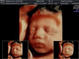 ❣️Our Squad just grew by one Heart🥰🥰 . 💙💙excited to introduce our  little boy '' CALEB MATHEW NITHIN '' 💙💙 . . Born