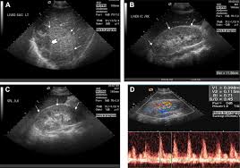 Radiologic Imaging Of The Renal Parenchyma Structure And Function | Nature  Reviews Nephrology