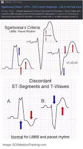 Go the extra mile offers questions for the nurses working in intensive care. Unofficial Cardiology Added A Unofficial Cardiology