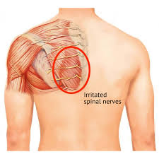 Image result for Paresthesia