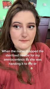 All eyes were literally