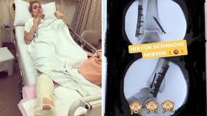 We would like to show you a description here but the site won't allow us. Dschungelcamp Reporterin Im Krankenhaus Der Horror Sturz Von Susanna Ohlen Stern De