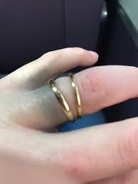Why is my silver ring turning black, brown or grey? Fingers Turning Black February 2019 Babies Forums What To Expect