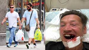 Eastenders veteran sid owen looked back to his best after his jaw was shattered and six teeth smashed out by a golf ball. Ex Eastenders Star Sid Owen Has Jaw Shattered By A Golf Ball On Thai Getaway Youtube