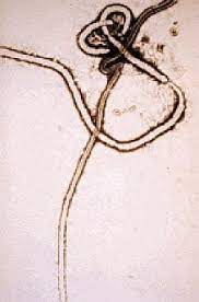 It first appeared in 1976 in 2 simultaneous outbreaks, one in what is now nzara, south sudan, and the other in yambuku, drc. Ebola Virus Infection Practice Essentials Background Pathophysiology And Etiology