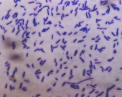 Hình ảnh về bacteria stained with Basic Violet 5BN