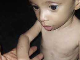 Fundraiser by manuela mancini : Let's Little Zakaria and his family Survive