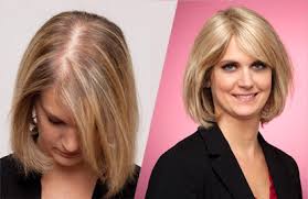 175,422 likes · 37,700 talking about this. Solutions Perte De Cheveux Due Au Stress Et Cheveux Fins