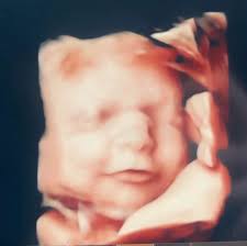 Melissa Cottom McGraw