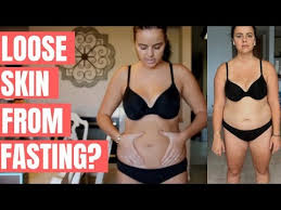 Do I Have Loose Skin From Fasting 54 Days Youtube