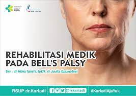 Prosedur ini relatif aman dan sangat bermanfaat bagi dokter spesialis dalam membantu membuat diagnosis yang lebih akurat dan terpercaya. Rehabilitasi Medik Pada Bells Palsy