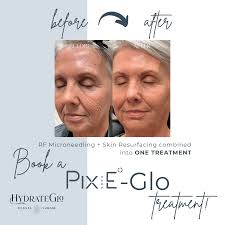 Luxury Medical Spa And IV Lounge In Odessa, FL