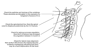 X Ray Skills 2 Cervical Spine X Ray Interpretation