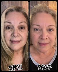 This lights me up!! I love this product!! Our little bottle of amazing does  it again 🤩 CHECK OUT these incredible results that Brandi has shared!!! I  had to share her results