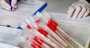Die interregionale blutspende srk ist einer von 11 regionalen blutspendediensten in der schweiz. Sars Cov 2 Drk Regt Antikorpertests Im Rahmen Von Blutspenden An