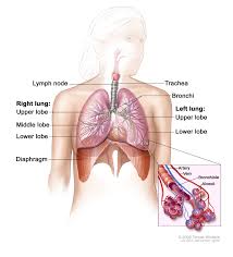 This is the period of time between exposure to asbestos and a diagnosis. Malignant Mesothelioma Treatment Mhealth Org