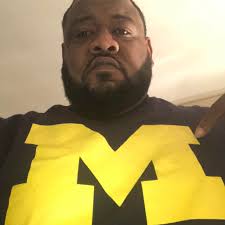 How much urine do you produce after a kidney transplant if you had a sleepy  kidney?