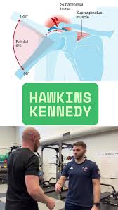 Image result for Hawkins Test