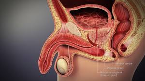 Image result for Prostate Cancer