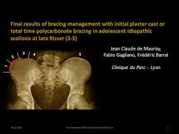 Image result for Risser Sign