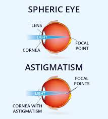 All eye shapes are beautiful, and once you know yours, you'll be able to accentuate the natural shape of your eyes with the right kind of eye makeup. What Is Astigmatism Vision Direct Uk