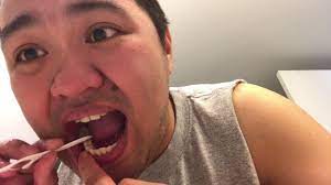 Wiggling a tooth requires nothing more than your hand and fingers, and it's a great way to help loosen up your tooth even more. Pulling My Own Tooth Youtube