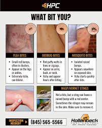 Image result for flea bites