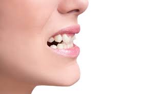 We did not find results for: How To Fix Crooked Teeth La Mesa Dental Center La Mesa Dentist San Diego
