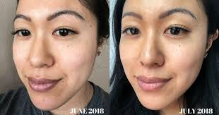Jun 12, 2020 · how long does glycolic acid take to work? How My Skin Changed Dramatically With Beautycounter S Overnight Resurfacing Peel What Great Grandma Ate