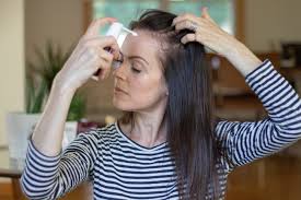 I received the fuller looking hair kit. The Answer To My Thinning Hair Dilemma Michelletyler