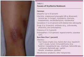 Image result for erythema nodosum