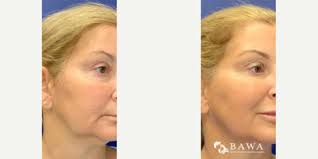 Kanwal Bawa, DO, Physician