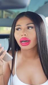 Lip filler disaster prank