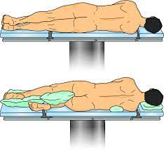 Because ourexperience withthistechnique inpatients withanaortic aneurysm islimited, noconclusion about itsefficacy canbedrawn. 2 Example Of Lateral Decubitus Position Download Scientific Diagram