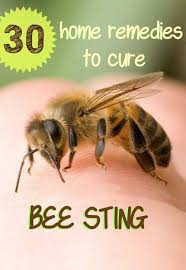 30 Useful Home Remedies To Get Rid Of Bee Sting Remedies For Bee Stings Treating Bee Stings Bee Sting Allergy