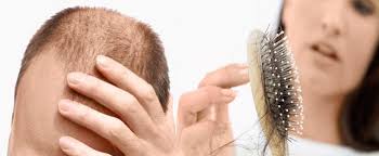 La caduta dei capelli può dipendere da ormoni, alimentazione, stress, fumo, alcol, sole, inquinamento e ai cosmetici che usi! Perdita Dei Capelli Nell Uomo E Nella Donna Cosa Dobbiamo Sapere