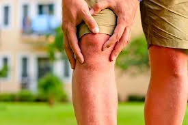 Bone cancer can weaken the bone it's in, but most of the time the bones do not fracture (break). Knee Lump Symptoms Causes Treatments