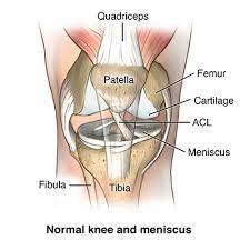 Try some homeopathic supplements as i got funny looks at the gym doing these funky exercises, but, i'm playing singles again without having. Torn Meniscus Cedars Sinai