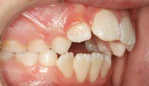 Pin On Best Orthodontist Miami