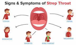 Image result for Strep throat infection roof of mouth