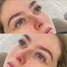 Brow Treatments Drogheda