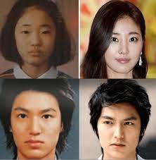 Celebrity Plastic Surgery Koreacelebrity Plastic Surgery Korea Celebrity Plastic Surgery Plastic Surgery Korea Celebrity Surgery