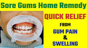 You can develop this issue due to gingivitis, an inflammation of the part of your gums that surround your teeth. Sore Gums Home Remedy Quick Relief From Gum Pain And Swelling 5 Minute Home Remedies Youtube