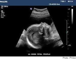 Vous pouvez calculer ces dates à partir du premier jour de vos dernières règles. 22eme Semaine De Grossesse 24 Sa Doctissimo