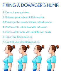 Dowager S Hump Fix Avoid A Dowager S Hump Granny Health Today Posture Correction Exercises Posture Exercises Neck Exercises