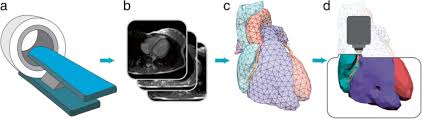 3D printing for congenital heart disease: a single site's initial  three-yearexperience