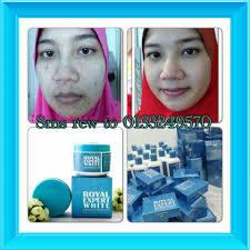 Atau, kita bisa coba untuk mendengarkan musik dan video lucu demi menghibur diri. Royal Cara Berkesan Merawat Kulit Jerawat Dan Kusam Facebook