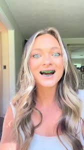 JUMP SCARE!!! hahahaha i had no idea they were green when i bought them..  #whiteningstrips #inopro